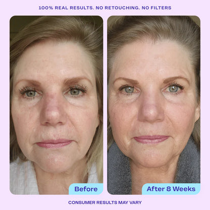 Anti Wrinkle Moisturizer